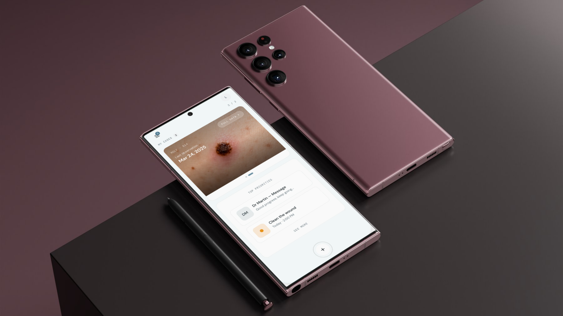 Smartphone mockup showing the TwinSkin app interface